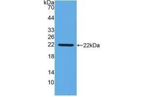 Detection of Recombinant IFNb, Gallus using Monoclonal Antibody to Interferon Beta (IFNb) (IFNB1 抗体  (AA 27-203))