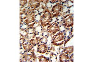 Immunohistochemistry (IHC) image for anti-Guanine Monophosphate Synthetase (GMPS) antibody (ABIN3001740) (GMP Synthase 抗体)