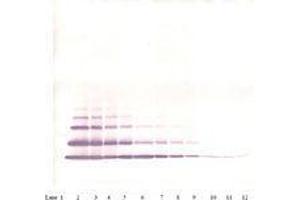 Image no. 2 for anti-Chemokine (C-X-C Motif) Ligand 2 (CXCL2) antibody (ABIN465915) (CXCL2 抗体)