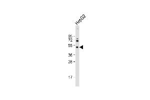 Anti-HEXA Antibody (N-term) at 1:2000 dilution + HepG2 whole cell lysate Lysates/proteins at 20 μg per lane.