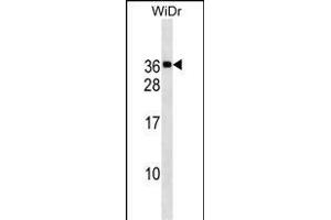 MED30 Antibody (Center) (ABIN1537737 and ABIN2838170) western blot analysis in WiDr cell line lysates (35 μg/lane).