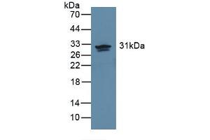 Western blot analysis of recombinant Human CA2. (CA2 抗体)