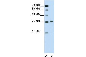 WB Suggested Anti-PIPOX Antibody Titration:  0. (PIPOX 抗体  (C-Term))