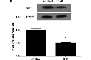 Down-regulation of Srx-1 in H9c2 cardiomyocytes under SI/R treatmentThe H9c2 cells were exposed to hypoxia for 10 h and then reoxygenated for 3 h. (Sulfiredoxin 1 抗体  (AA 45-137))