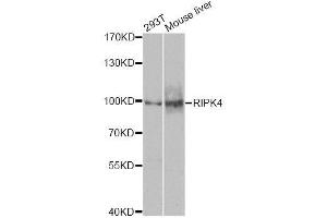 Western blot analysis of extracts of various cell lines, using RIPK4 antibody (ABIN5974690) at 1/1000 dilution. (RIPK4 抗体)