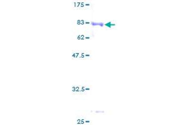 HARS1/Jo-1 Protein (AA 1-509) (GST tag)