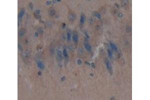 Used in DAB staining on fromalin fixed paraffin- embedded Kidney tissue (IDS 抗体  (AA 107-363))