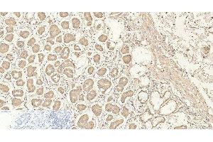Immunohistochemistry of paraffin-embedded Human stomach tissue using CD4 Monoclonal Antibody at dilution of 1:200. (CD4 抗体)