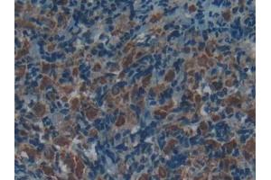 Immunohistochemistry (IHC) image for anti-Acid Phosphatase 5, Tartrate Resistant (ACP5) (AA 29-296) antibody (ABIN7432886)