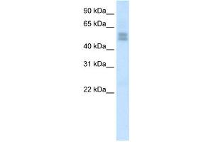 WB Suggested Anti-LMX1B Antibody Titration:  2. (LMX1B 抗体  (C-Term))