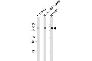 All lanes : Anti-DMRT2 Antibody (Center) at 1:2000 dilution Lane 1: human kidney lysate Lane 2: human skeletal muscle lysate Lane 3: human testis lysate Lysates/proteins at 20 μg per lane. (DMRT2 抗体  (AA 357-392))