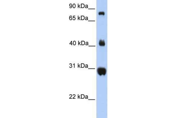FIBCD1 antibody  (C-Term)