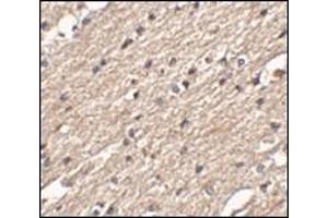 Immunohistochemistry of Spred3 in human brain tissue with this product at 2. (SPRED3 抗体  (Center))