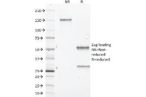 SDS-PAGE Analysis Purified Aurora B Mouse Monoclonal Antibody (AURKB/1845). (Aurora Kinase B 抗体  (AA 89-251))