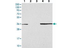 Western blot analysis of Lane 1: RT-4, Lane 2: U-251 MG, Lane 3: Human Plasma, Lane 4: Liver, Lane 5: Tonsil with FAM98C polyclonal antibody  at 1:250-1:500 dilution. (FAM98C 抗体)