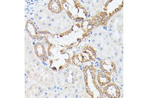 Immunohistochemistry (IHC) image for anti-Protein tyrosine Phosphatase Type IVA, Member 2 (PTP4A2) (AA 30-100) antibody (ABIN7269703)