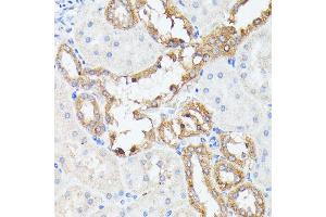 Immunohistochemistry of paraffin-embedded rat kidney using PTP4 antibody (ABIN7269703) at dilution of 1:100 (40x lens). (PTP4A2 抗体  (AA 30-100))