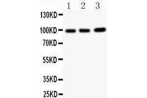 Western Blotting (WB) image for anti-erythrocyte Membrane Protein Band 4.1-Like 1 (EPB41L1) (AA 691-881) antibody (ABIN3042373) (EPB41L1 抗体  (AA 691-881))