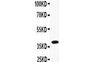 Anti- Furin Picoband antibody, Western blotting All lanes: Anti Furin  at 0. (FURIN 抗体  (AA 591-794))