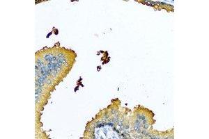 Immunohistochemical analysis of Nyctalopin staining in human prostate formalin fixed paraffin embedded tissue section. (Nyctalopin 抗体)