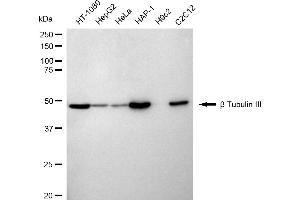 Western blotting analysis using beta Tubulin III antibody (ABIN7800669).