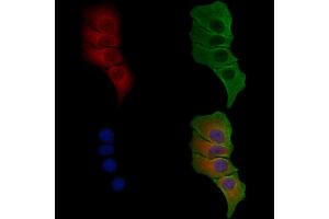 ABIN6258671 and ABIN6275143 staining Hela cells by IF/ICC. (TUBGCP4 抗体  (Internal Region))