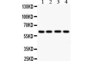 Anti- HEXA antibody, Western blottingAll lanes: Anti HEXA  at 0. (Hexosaminidase A 抗体  (C-Term))