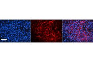 Rabbit Anti-PGRC2 Antibody   Formalin Fixed Paraffin Embedded Tissue: Human Testis Tissue Observed Staining: Plasma membrane in spermatozoa Primary Antibody Concentration: 1:100 Other Working Concentrations: 1:600 Secondary Antibody: Donkey anti-Rabbit-Cy3 Secondary Antibody Concentration: 1:200 Magnification: 20X Exposure Time: 0. (PGRMC1 抗体  (C-Term))