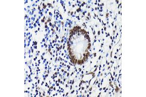 Immunohistochemistry of paraffin-embedded human appendix using K/TRIM28 antibody (ABIN7270986) at dilution of 1:100 (40x lens). (KAP1 抗体)