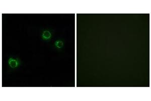 Immunofluorescence analysis of HUVEC cells, using CLDN6 antibody. (Claudin 6 抗体  (Internal Region))