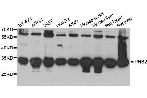 Western blot analysis of extracts of various cell lines, using PHB2 antibody. (Prohibitin 2 抗体  (AA 1-299))