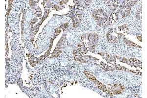 IHC analysis of DPY19L1 using anti-DPY19L1 antibody (ABIN7601445). (DPY19L1 抗体  (AA 354-657))