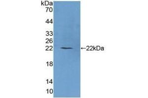 Detection of Recombinant PLCb1, Human using Polyclonal Antibody to Phospholipase C Beta 1 (PLCB1) (Phospholipase C beta 1 抗体  (AA 316-476))