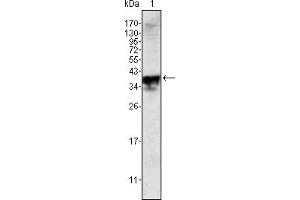 Western blot analysis using Androgen receptor mouse mAb against Androgen receptor (aa221-321)-hIgGFc transfected HEK293 cell lysate. (Androgen Receptor 抗体)
