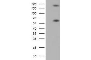 Western Blotting (WB) image for anti-Butyrophilin, Subfamily 1, Member A1 (BTN1A1) antibody (ABIN1496988) (BTN1A1 抗体)