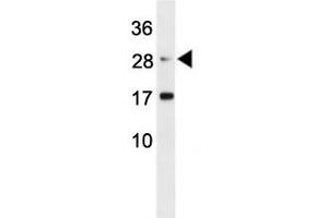 Erythropoietin antibody western blot analysis in mouse L929 lysate