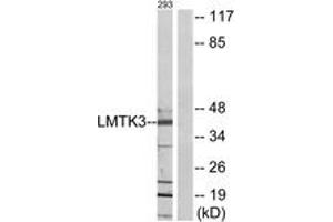 Western blot analysis of extracts from 293 cells, using LMTK3 Antibody. (LMTK3 抗体  (AA 1251-1300))