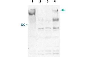 Western blot was performed on whole cell lysates from mouse embryonic stem cells (E14Tg2a) with Mll4 polyclonal antibody , diluted 1 : 500 in PBS-Tween containing 5% skimmed milk. (MLL4 抗体)