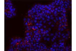 Immunofluorescence (IF) image for anti-CD24 Molecule (CD24) antibody (Alexa Fluor 647) (ABIN2657702) (CD24 抗体  (Alexa Fluor 647))