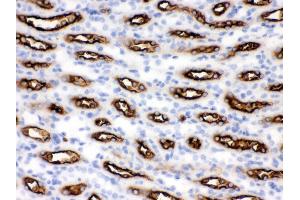 Immunohistochemistry (IHC) image for anti-Solute Carrier Family 12 (Sodium/potassium/chloride Transporters), Member 1 (SLC12A1) (AA 52-83), (N-Term) antibody (ABIN3043925)