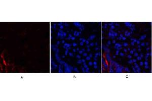 Immunofluorescence analysis of rat lung tissue. (PI3K p85 alpha/gamma 抗体)