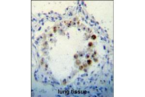 CDKN2B Antibody immunohistochemistry analysis in formalin fixed and paraffin embedded human lung tissue followed by peroxidase conjugation of the secondary antibody and DAB staining. (CDKN2B 抗体  (C-Term))