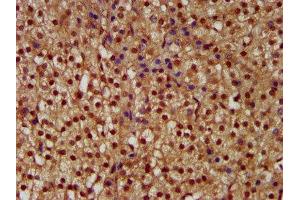 IHC image of ABIN7169088 diluted at 1:300 and staining in paraffin-embedded human adrenal gland tissue performed on a Leica BondTM system. (NEK1 抗体  (AA 626-809))
