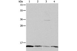 Western Blot analysis of Hela, Jurkat, MCF7 and A431 cell using ATPIF1 Polyclonal Antibody at dilution of 1:1200 (ATPase Inhibitory Factor 1 抗体)