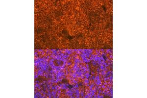 Immunofluorescence analysis of rat spleen using CD3D Rabbit mAb (ABIN7266193) at dilution of 1:100 (40x lens). (CD3D 抗体)