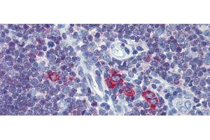 Immunohistochemistry with Human Thymus lysate tissue at an antibody concentration of 5. (Transferrin Receptor 2 抗体  (Middle Region))