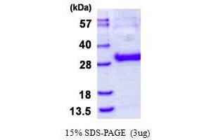 Image no. 1 for Thymidine Kinase 1, Soluble (TK1) protein (His tag) (ABIN1098640)