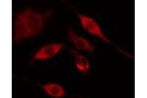 ABIN6275309 staining COLO205 cells by IF/ICC. (PNPLA6 抗体  (Internal Region))
