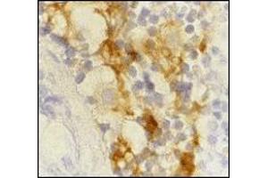 Immunohistochemistry (IHC) image for anti-CD209 (CD209) (Extracellular Domain) antibody (ABIN492511)
