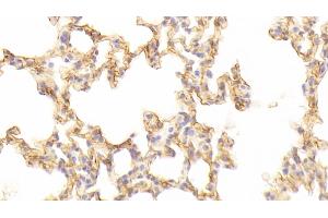Detection of ICAM1 in Mouse Lung Tissue using Polyclonal Antibody to Intercellular Adhesion Molecule 1 (ICAM1) (ICAM1 抗体  (AA 328-465))